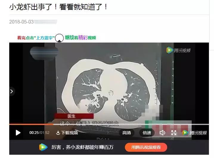 吃小龙虾会染肺吸虫病？小龙虾：这锅我不背(图1)