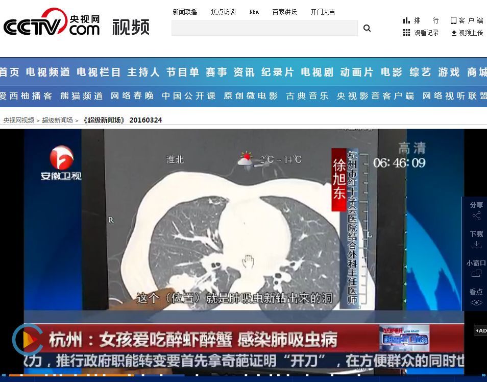 吃小龙虾会染肺吸虫病？小龙虾：这锅我不背(图2)