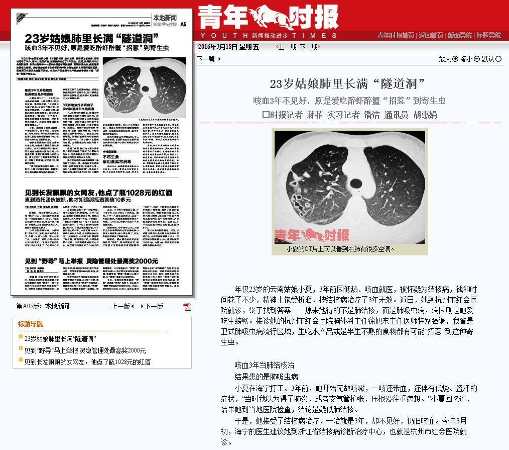 吃小龙虾会染肺吸虫病？小龙虾：这锅我不背(图3)
